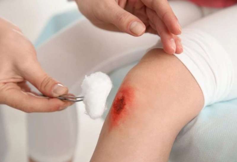 Chuối thúc đẩy quá trình làm lành vết thương