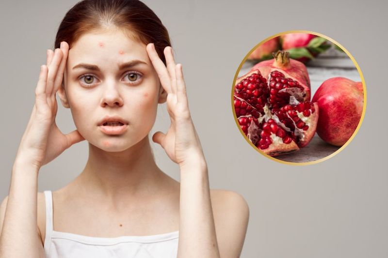 Ăn nhiều lựu có thể gây nóng và mọc mụn