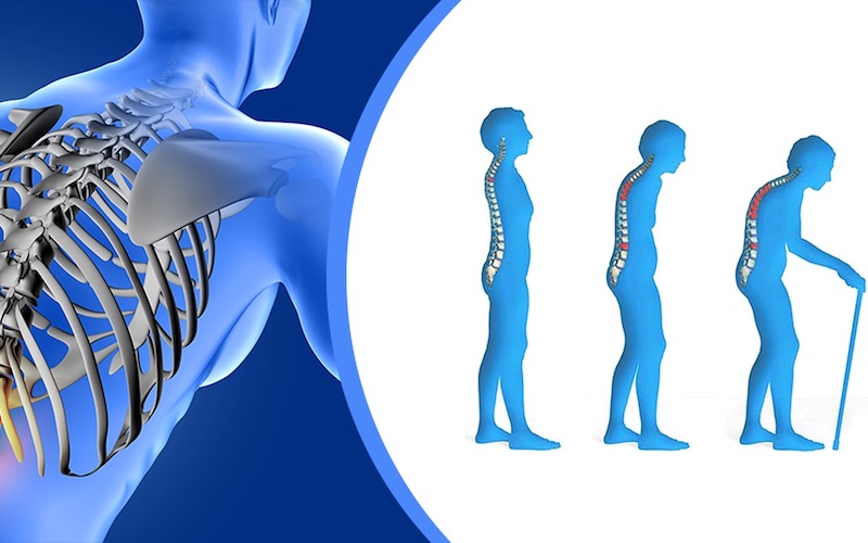 Người bị loãng xương nên tham vấn ý kiến bác sĩ trước khi sử dụng ghế massage