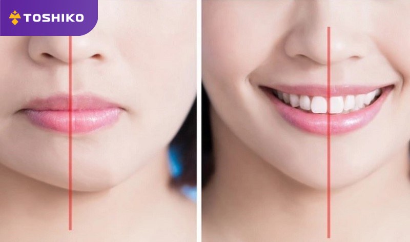 5 cách massage khắc phục mặt lệch tại nhà hiệu quả