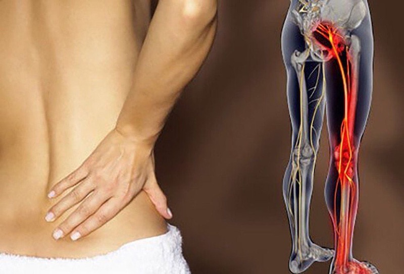 Các bệnh lý xương khớp khiến cơn đau lưng trở nên trầm trọng hơn