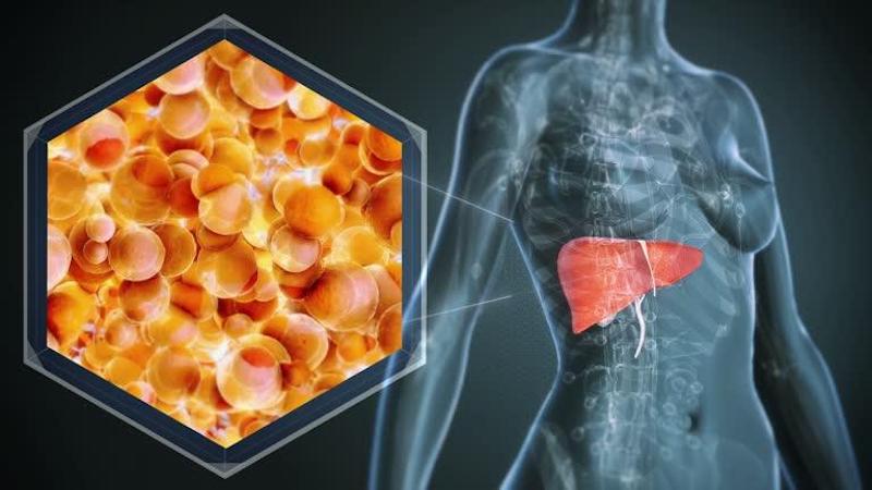 Chạy bộ giúp phòng ngừa các bệnh lý về gan khác