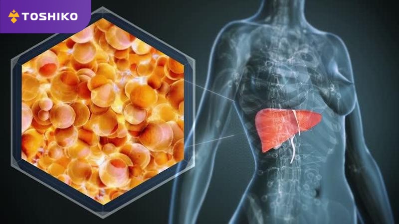 Chạy bộ có tốt cho gan không? 5 lợi ích ít ai biết