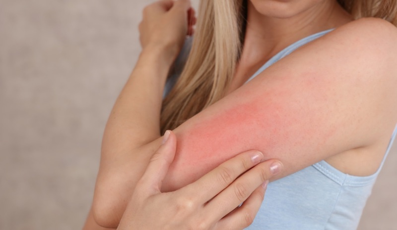Da bọc ghế không sạch có thể gây kích ứng khi nằm