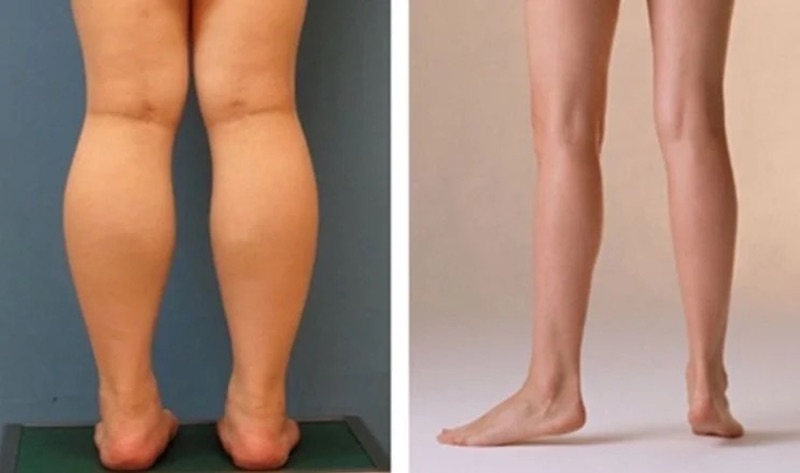 Điều chỉnh cường độ và thời gian đạp xe hợp lý