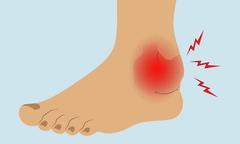 Nếu tình trạng đau nhức không thuyên giảm cần thăm khám bác sĩ ngay