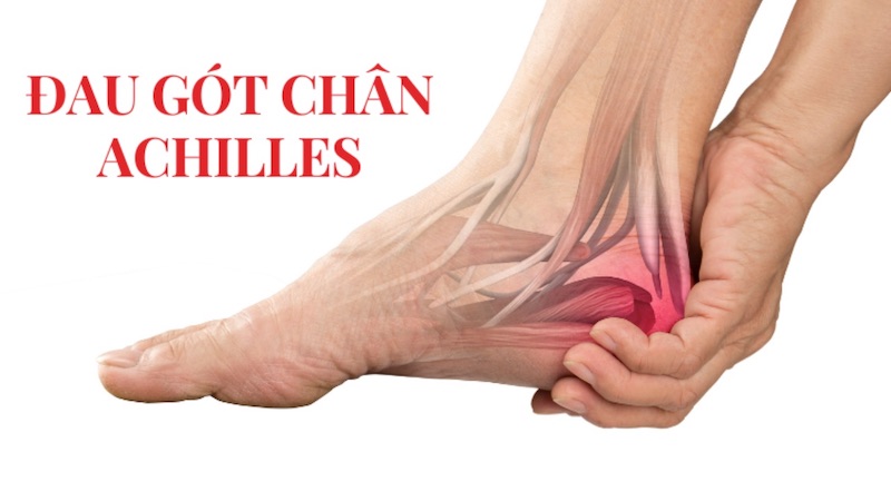 Viêm gân Achilles làm tăng nguy cơ đau gót chân