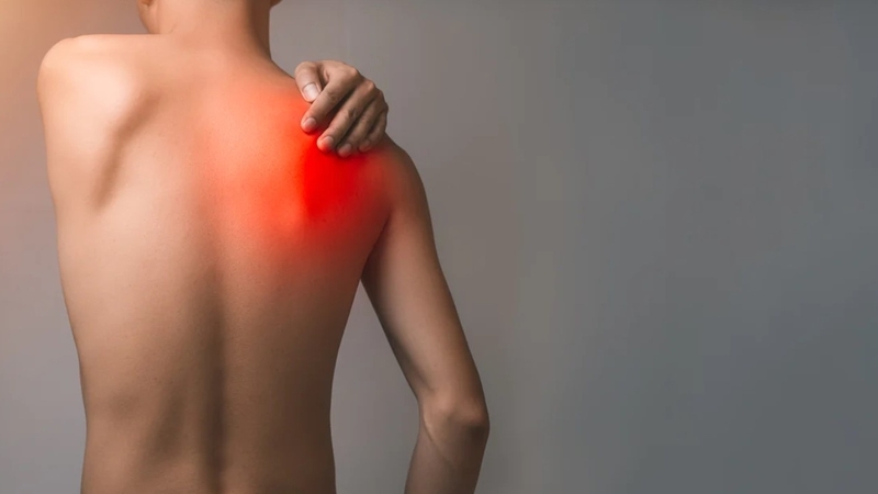 Đau vai gáy cổ bên phải là tình trạng đau nhức, co cứng cơ