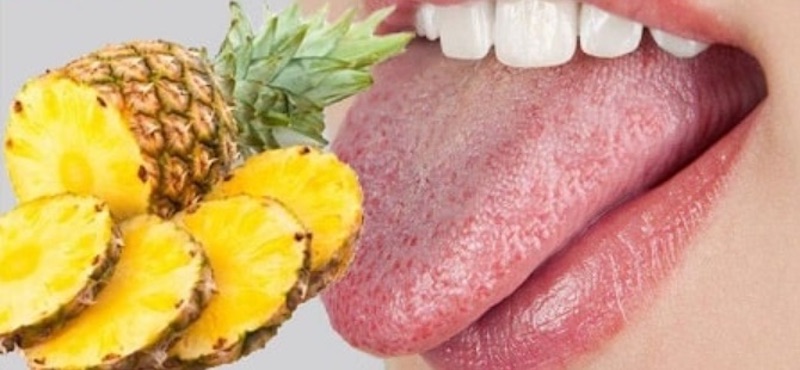 Ăn dứa có thể gây rát lưỡi