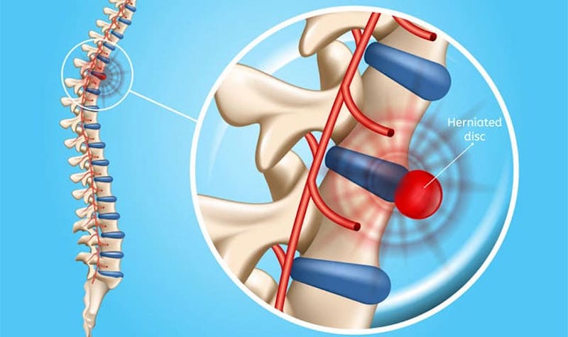 Ngồi ghế massage giúp giảm bớt áp lực lên đốt sống