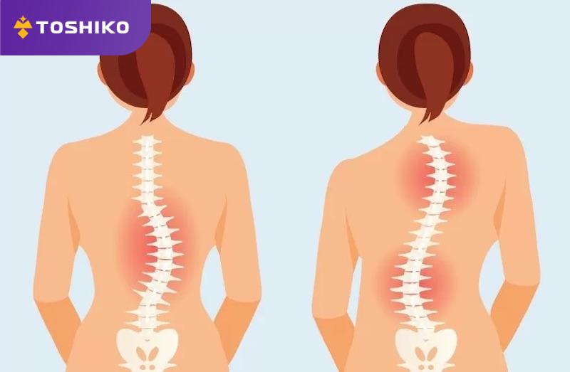 Lý giải Ghế massage có thể cải thiện vẹo cột sống không?