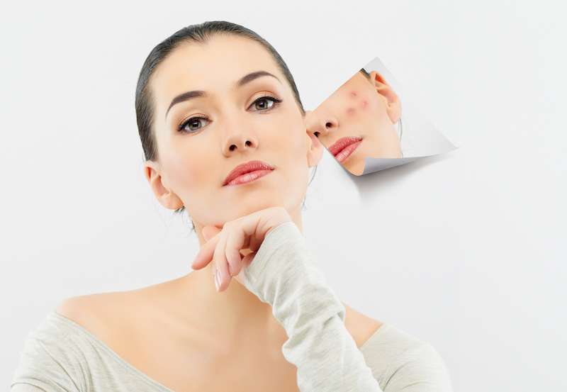 Massage giúp giảm nguy cơ hình thành mụn