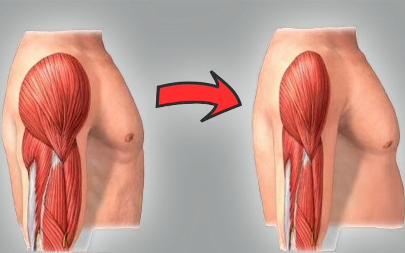 Mất cơ là tình trạng không hiếm gặp