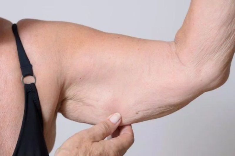 Mặc dù giảm cân nhưng tỷ lệ mỡ vẫn không thay đổi