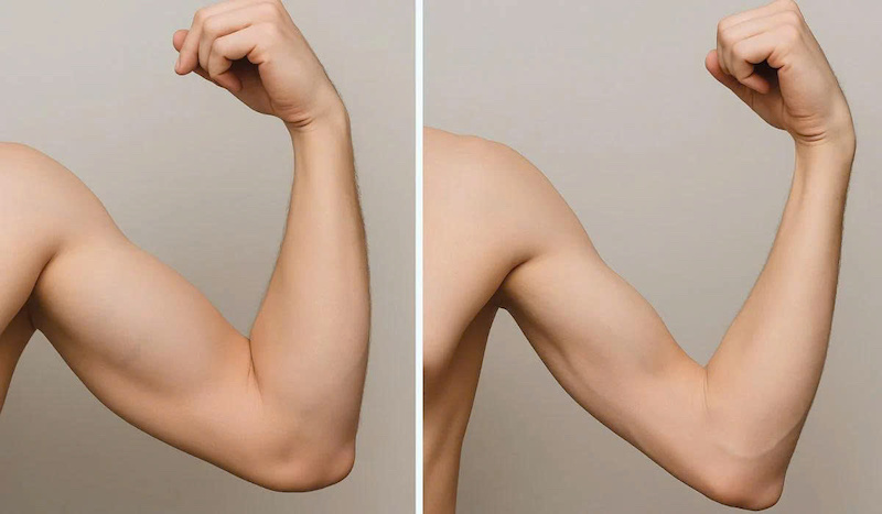 Mất cơ gây ra tâm lý tự ti do vóc dáng không còn săn chắc