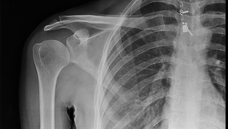 Nên thăm khám để được đề xuất hướng điều trị tốt nhất