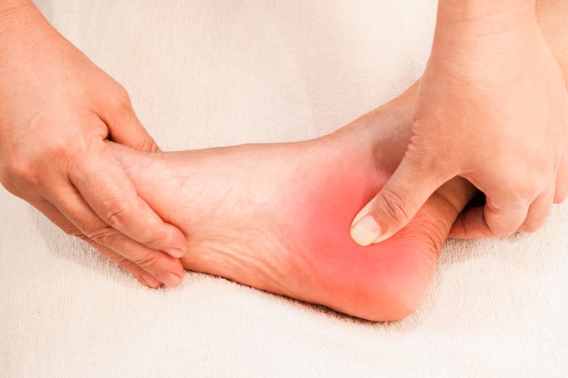 Nguyên nhân, triệu chứng và cách chữa nhức gót chân, ảnh 3