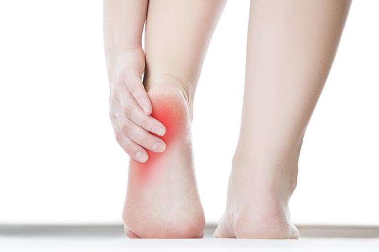 Nguyên nhân, triệu chứng và cách chữa nhức gót chân, ảnh 2