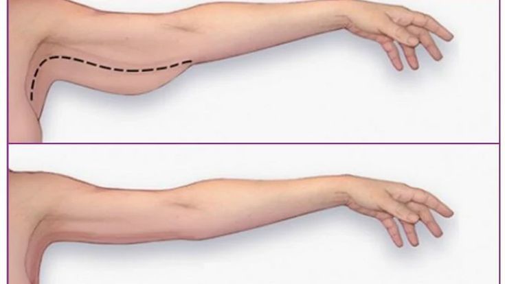 Bắp tay to là do chịu ảnh hưởng của rất nhiều yêu tố