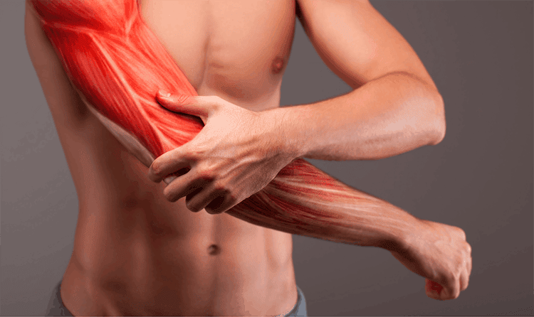 Mới tập gym bị đau cơ là trường hợp rất phổ biến