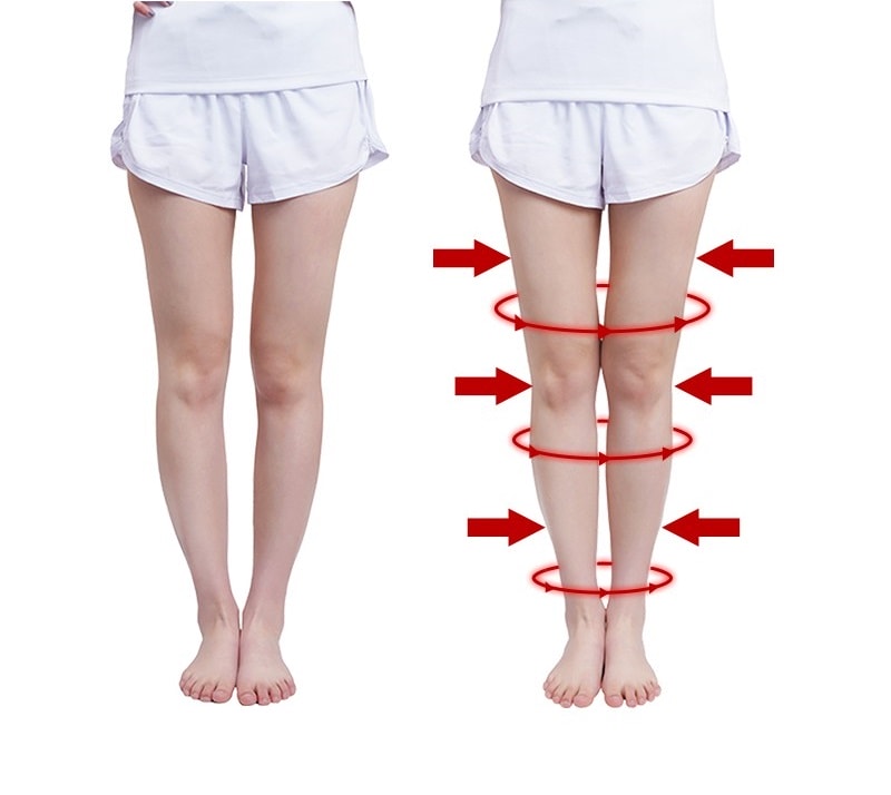 Thế nào là chân vòng kiềng? Cách khắc phục chân vòng kiềng