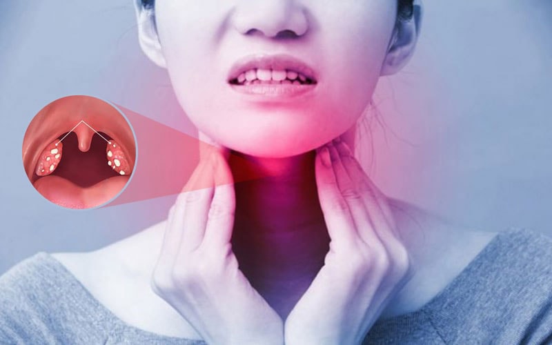 Khạc đờm ra máu – Dấu hiệu nguy hiểm cần đi khám ngay, ảnh 2