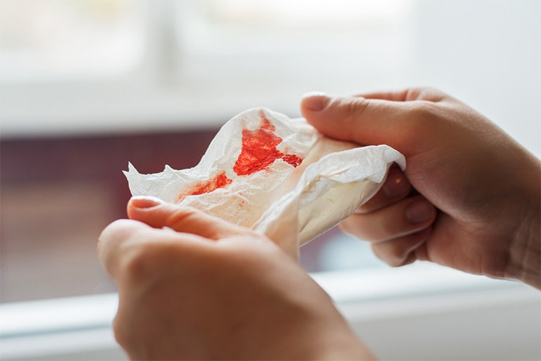 Khạc đờm ra máu – Dấu hiệu nguy hiểm cần đi khám ngay
