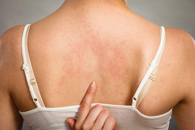 Quả mận bao nhiêu calo? Ăn mận có “thật sự” béo không?, ảnh 4
