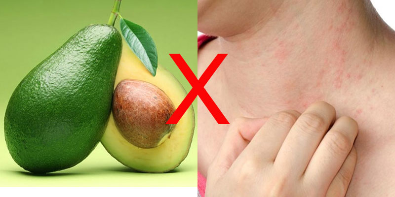 Một số người có thể xuất hiện triệu chứng mẩn ngứa sau khi ăn bơ