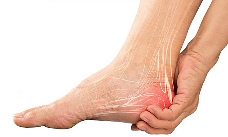 cách chữa nhức gót chân-1